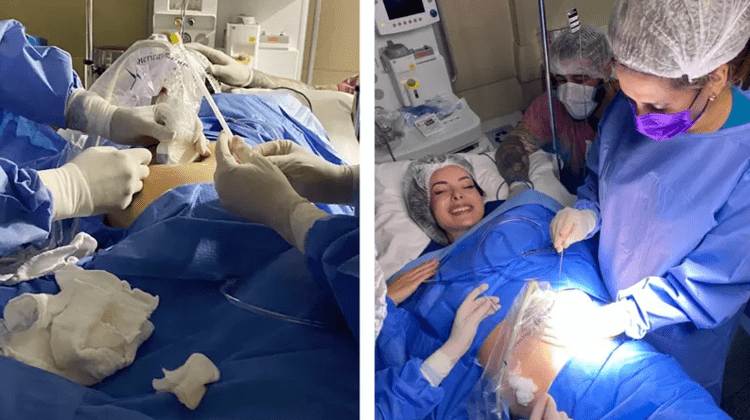 Extraordinaria operación: médicos quemaron el tumor de un bebé en el útero para salvarle la vida