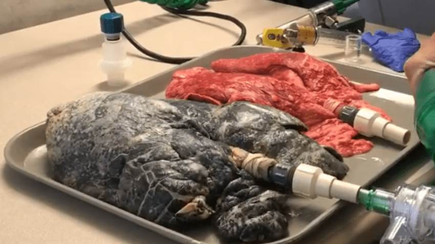 Dejar de fumar tras el diagnóstico de cáncer de pulmón mejora supervivencia global, según estudio