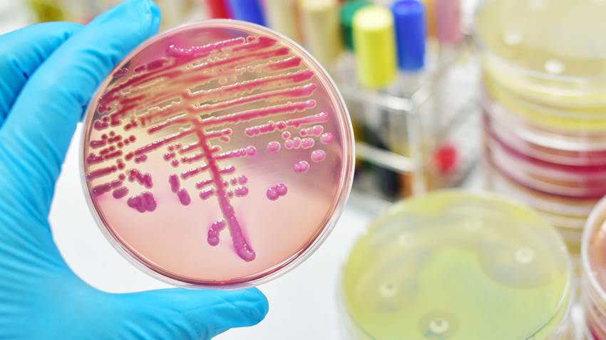 Así es la Klebsiella, una superbacteria que resiste a los antibióticos y se contagia en los hospitales
