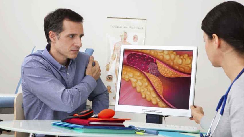 Identifican proteína que bloquea capacidad del organismo para eliminar el colesterol LDL