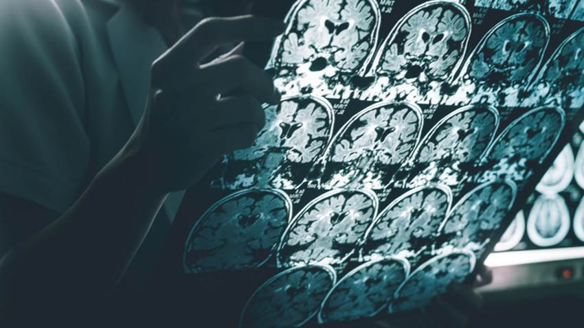 Desde la adolescencia se podrían detectar biomarcadores del alzhéimer