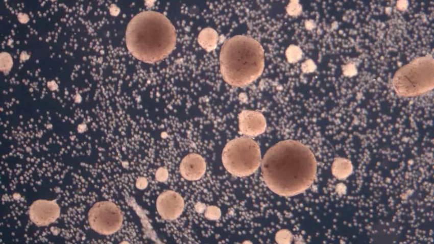 Adultos jóvenes con cáncer pueden optar por tratamientos distintos que pacientes mayores, según estudio