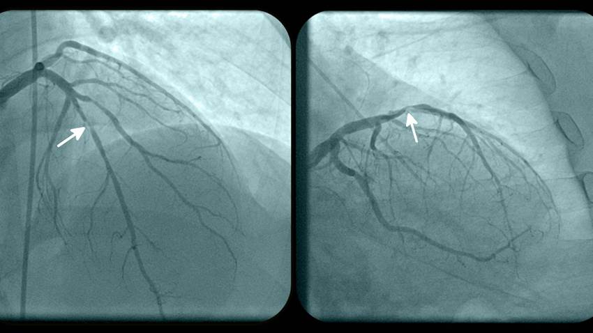 Salud