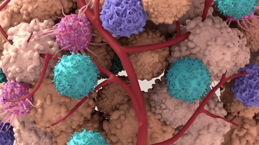 Nuevo mecanismo detendría progreso del cáncer a través del metabolismo tumoral