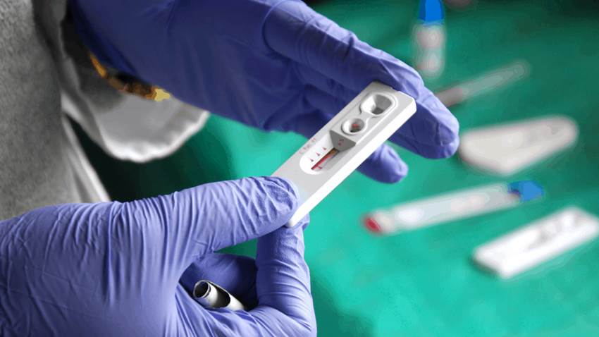 El tratamiento temprano contra el VIH podría revertir el envejecimiento prematuro