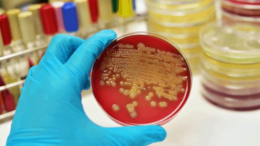 Creada una cepa sintética de la bacteria Escherichia coli resistente a los virus