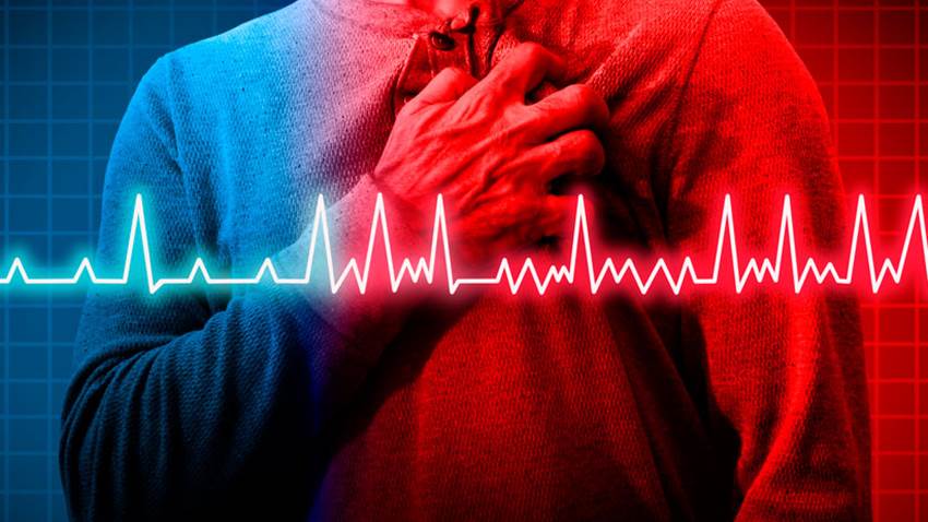 Fibrilación atrial: causas, prevención, y tratamiento