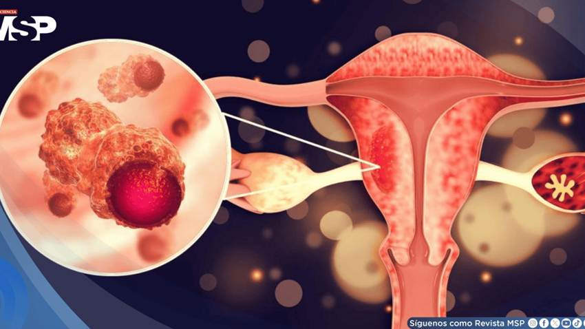 ¿Cansancio extremo durante la menstruación?: Podría ser SOP, trastorno disfórico premenstrual o anemia