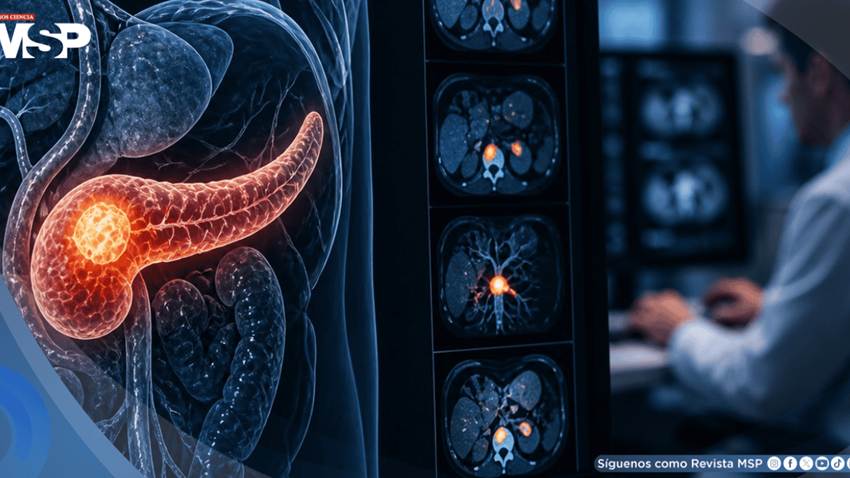 Desarrollan una IA que detectó cáncer de páncreas 475 días antes que el diagnóstico clínico