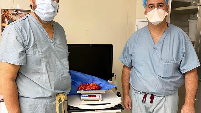 Logran extraer gigante tumor del tórax de una mujer en Puerto Rico contra todo pronóstico