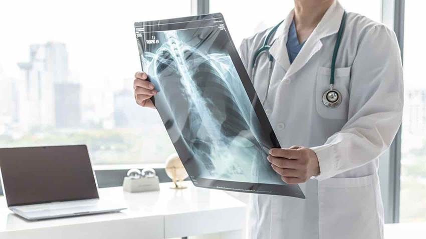 La hipertensión pulmonar es común en la diabetes tipo 2