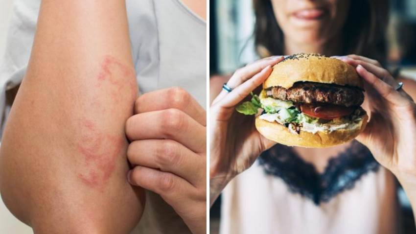 La picadura de un insecto podría hacer que dejes de comer carne para siempre: te explicamos