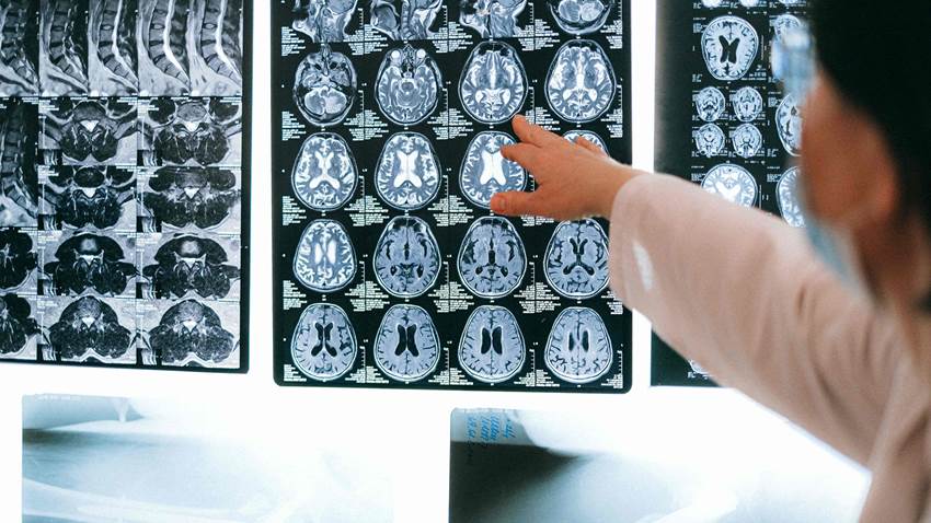Beber café y té con moderación se vincula a un menor riesgo de accidente cerebrovascular y demencia