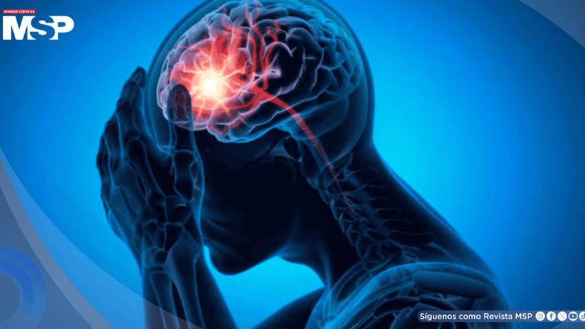 Estas son las señales silenciosas del infarto cerebral que aparecen días antes de que ocurra