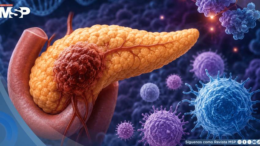 Estudio propone estrategia contra el cáncer de páncreas: bloquea proteína clave y activa sistema inmune