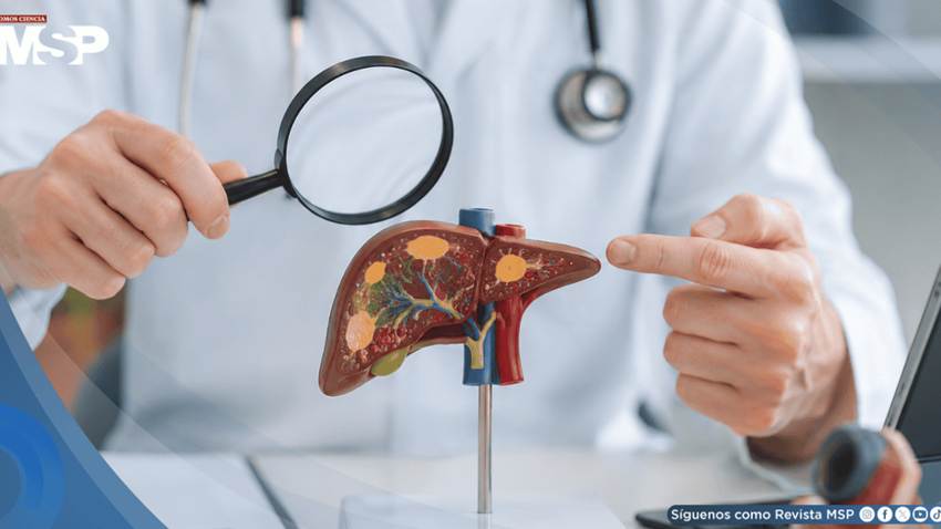Hepatitis Delta enciende alertas por su vínculo con cáncer hepático y riesgo de evolución acelerada