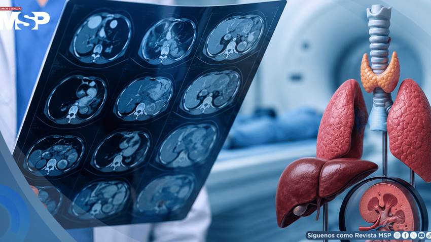 Cuatro tipos de cáncer que suelen descubrirse de forma inesperada en estudios médicos
