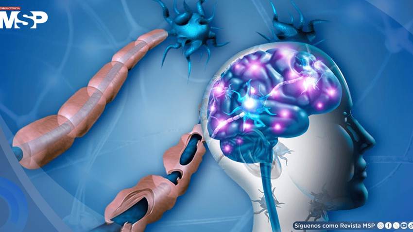 Virus de Epstein-Barr podría desencadenar ataques inmunitarios al cerebro que causan esclerosis múltiple