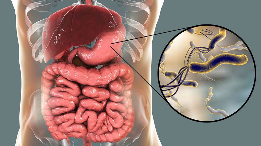 Estudio sugiere que existe sobre prescripción de la claritromicina para combatir la Helicobacter pylori