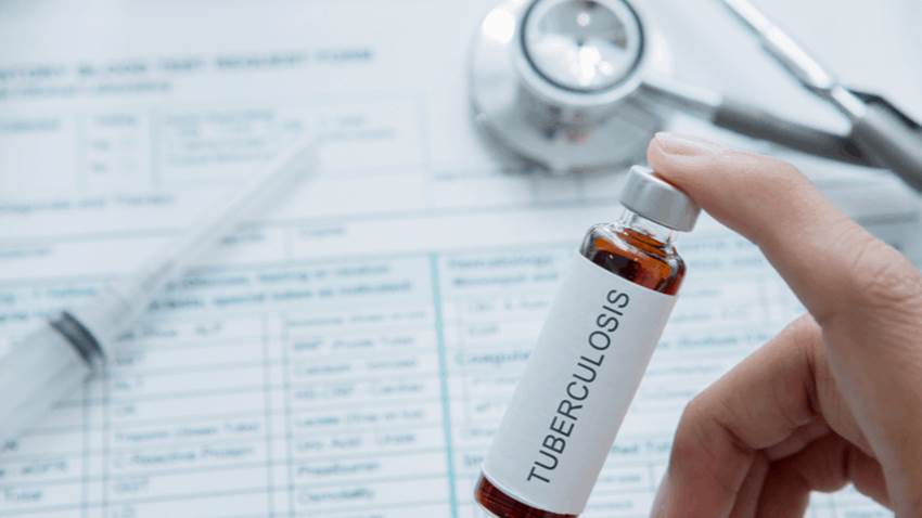 Nueva vacuna para prevenir la tuberculosis está cada vez más cerca