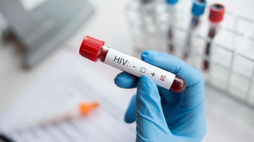 VIH se relaciona con riesgo mayor de hospitalización por COVID-19 y muerte